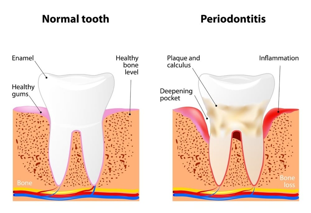 Sullivant Dentistry in Mountain Home, AR